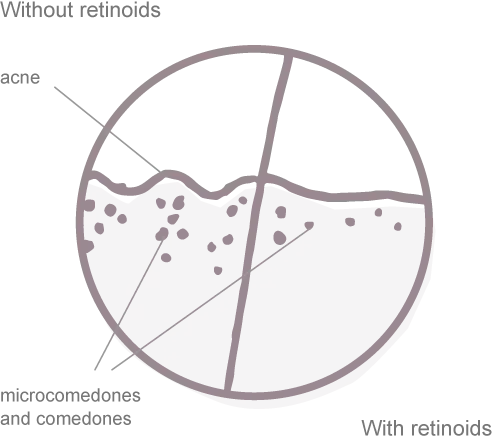 A pie chart with three labeled sections: one large and light green, one medium and darker green, and one small in dark purple. Simple design with no numeric or text details visible.